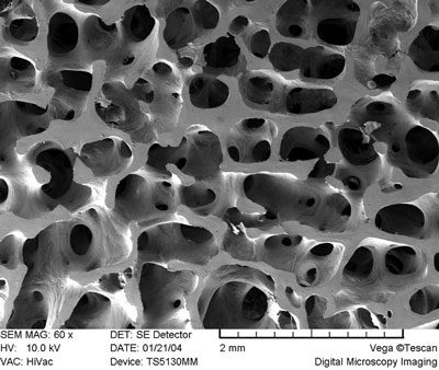 Microscopic image of human bone